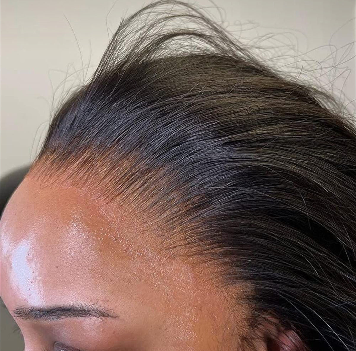Pre-Coloured HD Lace Closures - CHOOSE YOUR SHADE